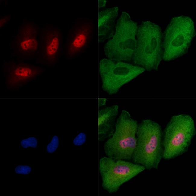 RAP1 Antibody in Immunocytochemistry (ICC/IF)