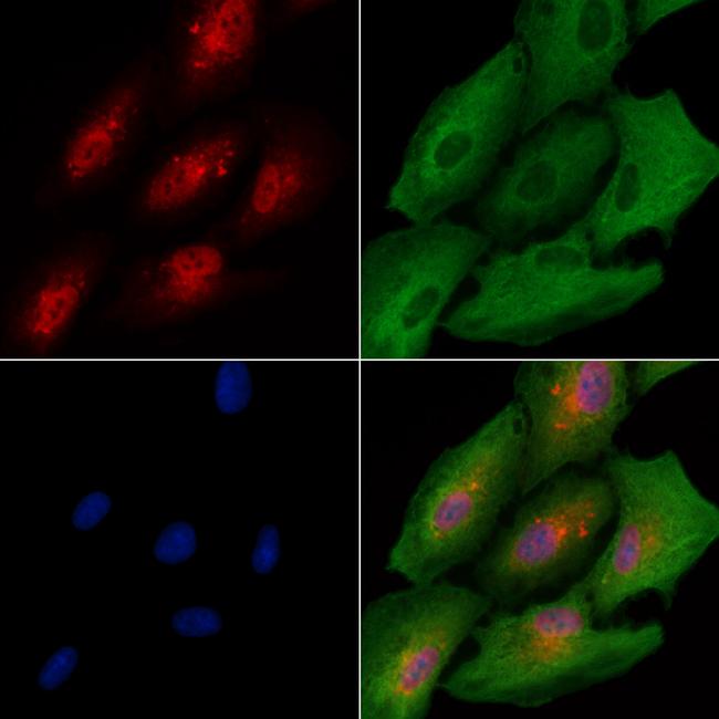 RFC3 Antibody in Immunocytochemistry (ICC/IF)