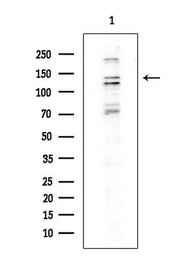 Drosha Antibody in Western Blot (WB)