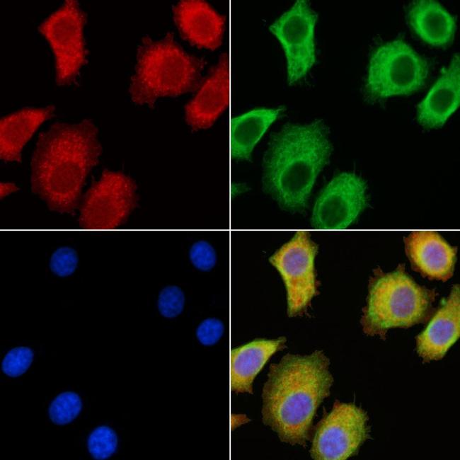 SEMA3C Antibody in Immunocytochemistry (ICC/IF)