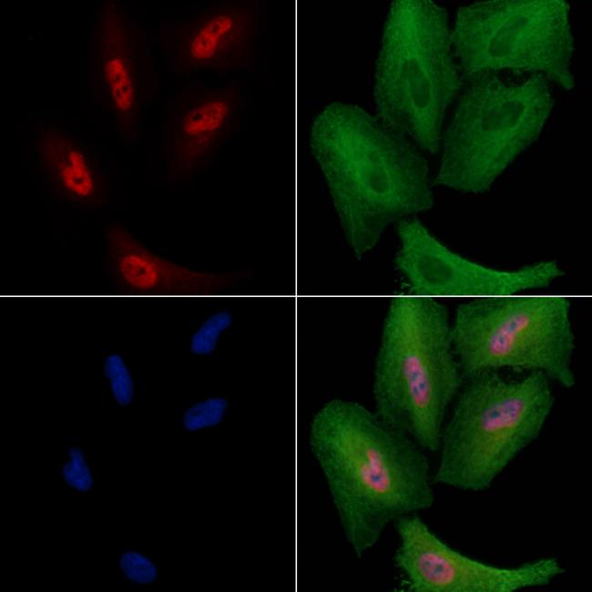 Cdc23 Antibody in Immunocytochemistry (ICC/IF)