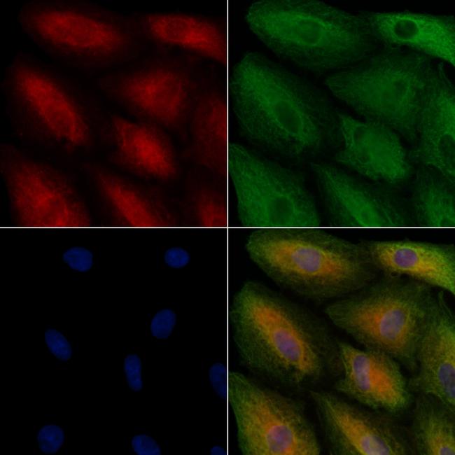 HSD17B11 Antibody in Immunocytochemistry (ICC/IF)