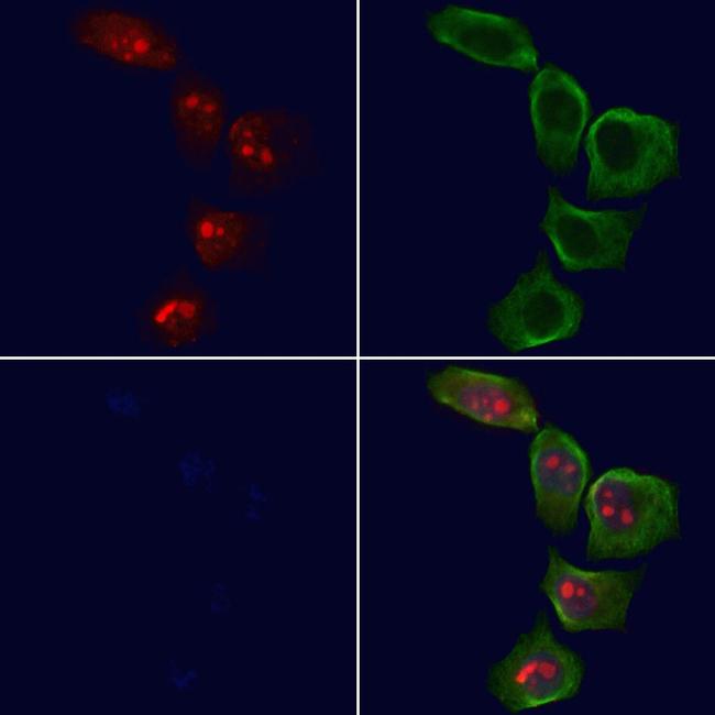 NF1 Antibody in Immunocytochemistry (ICC/IF)