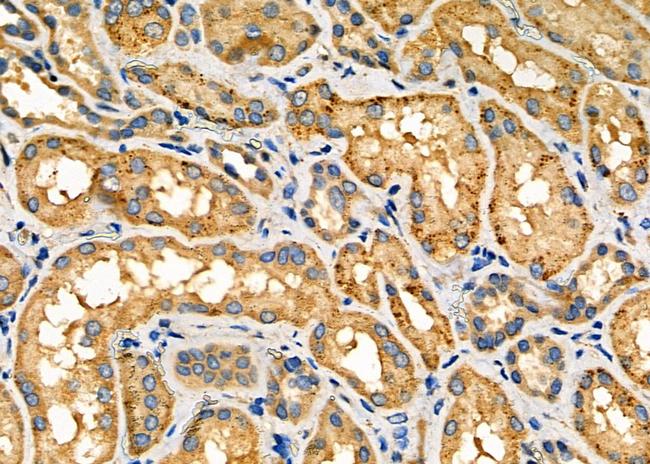 NOX1 Antibody in Immunohistochemistry (Paraffin) (IHC (P))