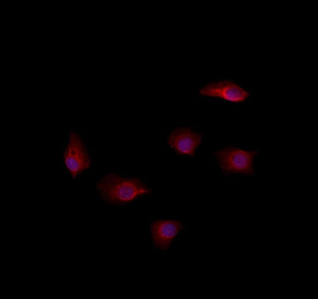 RAB35 Antibody in Immunocytochemistry (ICC/IF)