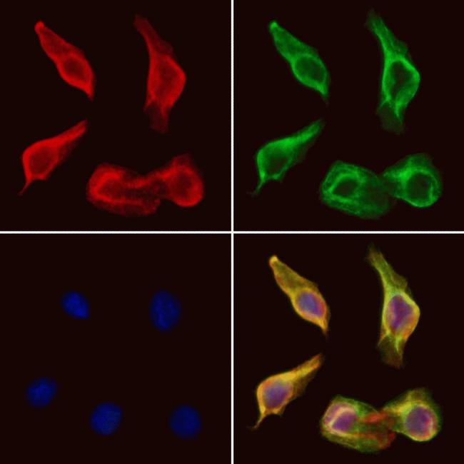 Slc30A8 Antibody in Immunocytochemistry (ICC/IF)