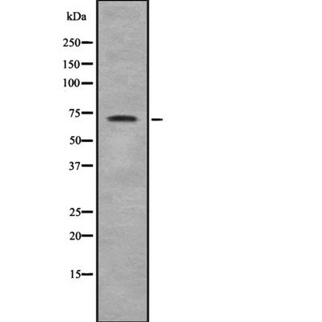 ZNF23 Antibody in Western Blot (WB)