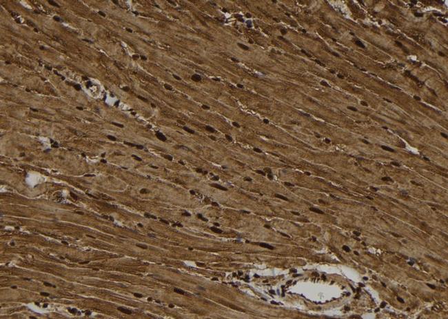 Phospho-CK1 alpha (Tyr294) Antibody in Immunohistochemistry (Paraffin) (IHC (P))