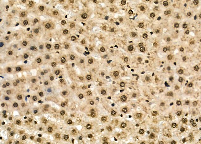 HOXA2 Antibody in Immunohistochemistry (Paraffin) (IHC (P))