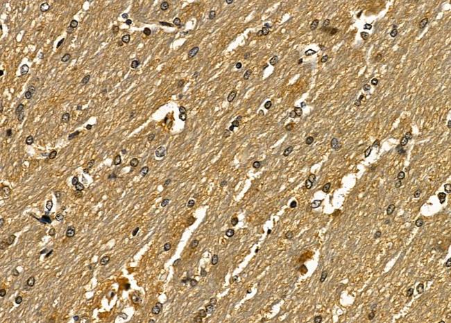 SNAPC5 Antibody in Immunohistochemistry (Paraffin) (IHC (P))