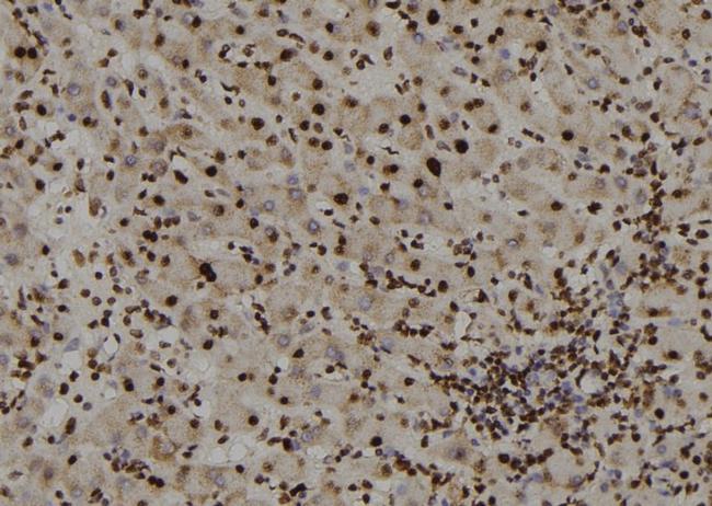 ZIC Pan Antibody in Immunohistochemistry (Paraffin) (IHC (P))