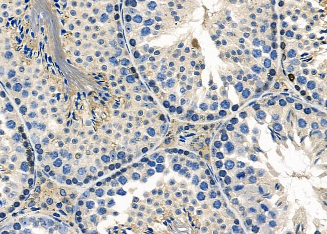 Herpes Simplex Virus Type 1 (strain 17) Antibody in Immunohistochemistry (Paraffin) (IHC (P))