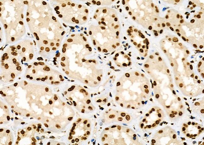 GTF2A2 Antibody in Immunohistochemistry (Paraffin) (IHC (P))