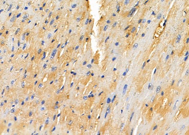 SNRPD3 Antibody in Immunohistochemistry (Paraffin) (IHC (P))