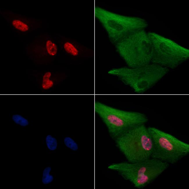 EMX2 Antibody in Immunocytochemistry (ICC/IF)