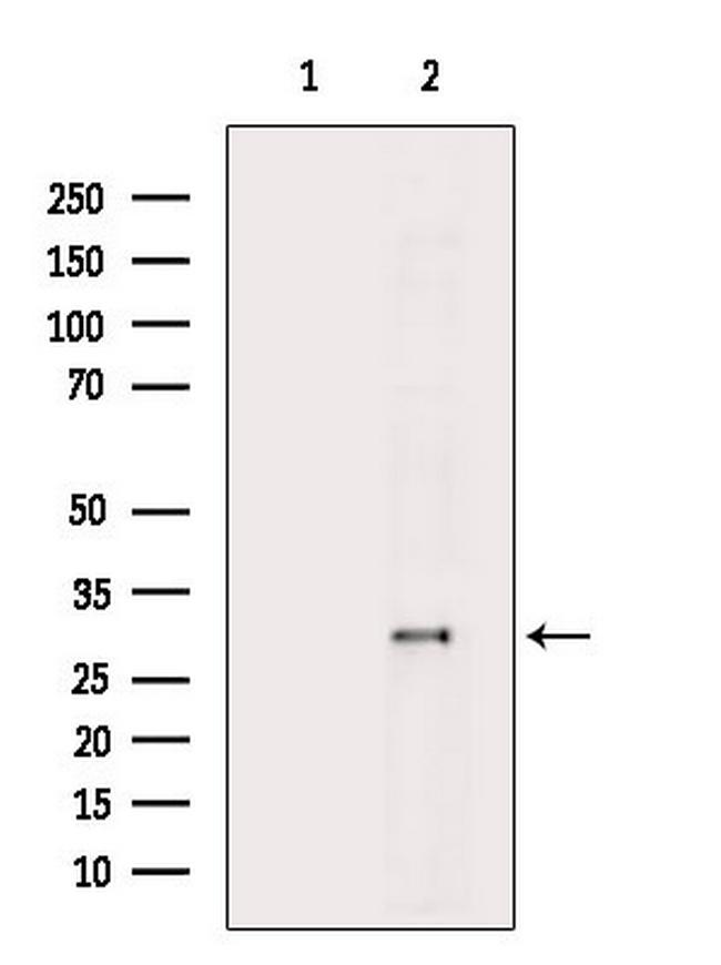 HNRNPA0 Antibody in Western Blot (WB)