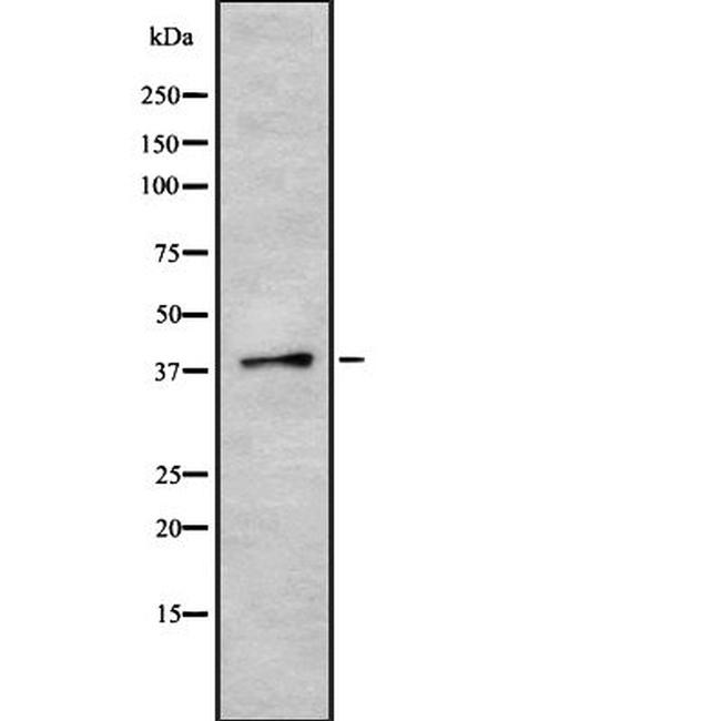 SRSF6 Antibody in Western Blot (WB)