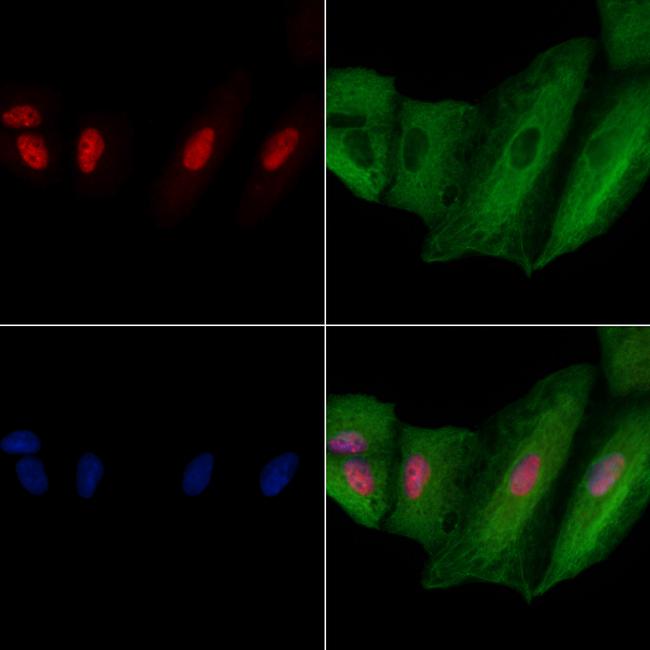 SART3 Antibody in Immunocytochemistry (ICC/IF)