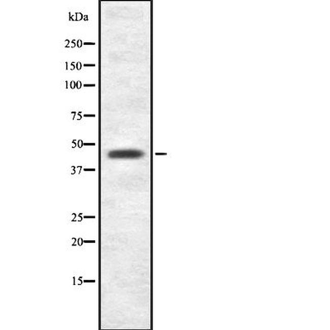 AGK Antibody in Western Blot (WB)