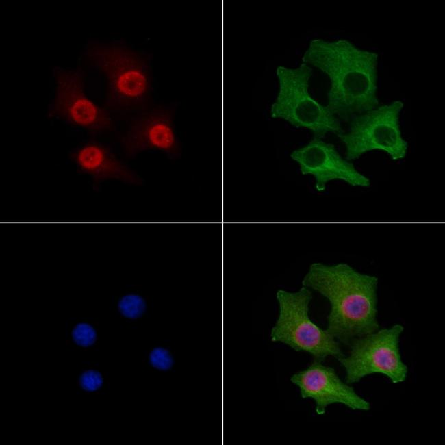 ZFPM2 Antibody in Immunocytochemistry (ICC/IF)