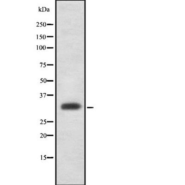 ZMAT3 Antibody in Western Blot (WB)