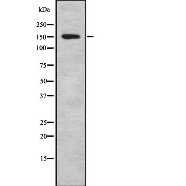 IBTK Antibody in Western Blot (WB)