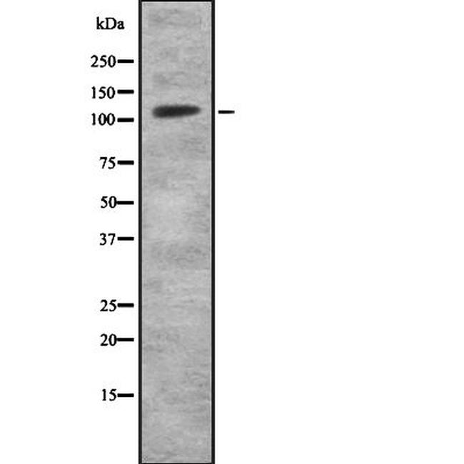 MKL2 Antibody in Western Blot (WB)