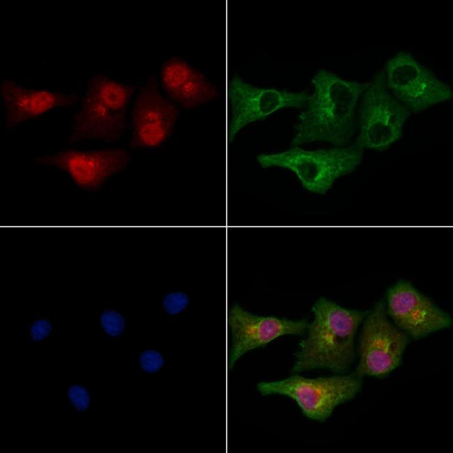 MLL4 Antibody in Immunocytochemistry (ICC/IF)