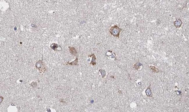 HTR2A Antibody in Immunohistochemistry (Paraffin) (IHC (P))