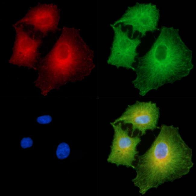 COL8A1 Antibody in Immunocytochemistry (ICC/IF)