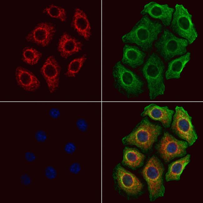 CALY Antibody in Immunocytochemistry (ICC/IF)