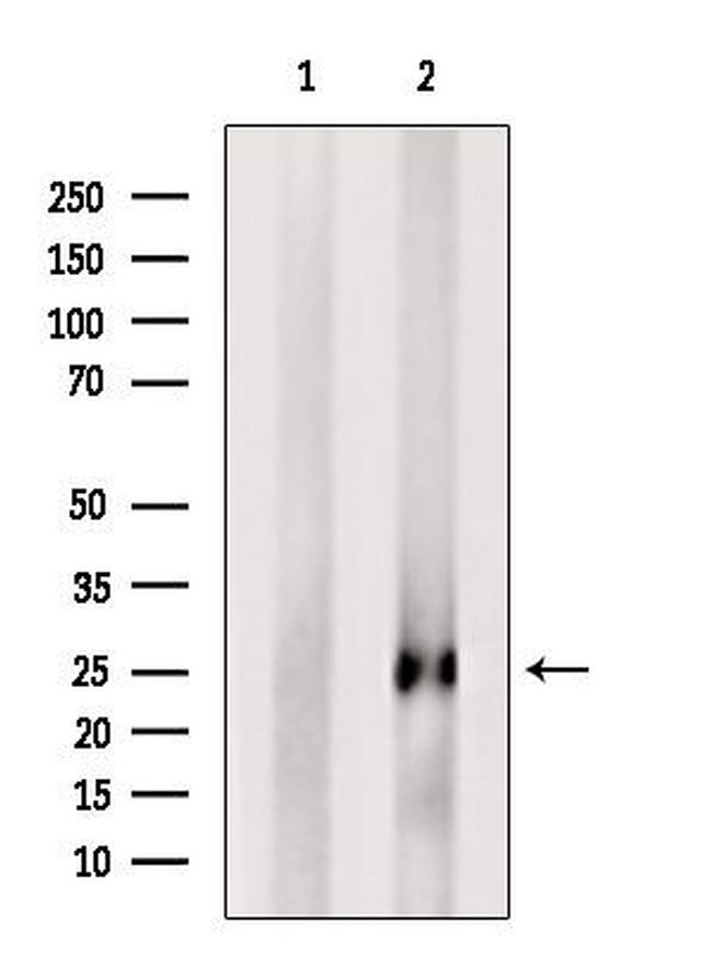 FGF11 Antibody in Western Blot (WB)