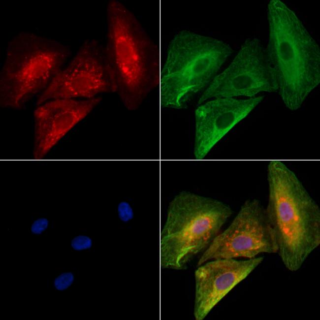 FGF20 Antibody in Immunocytochemistry (ICC/IF)