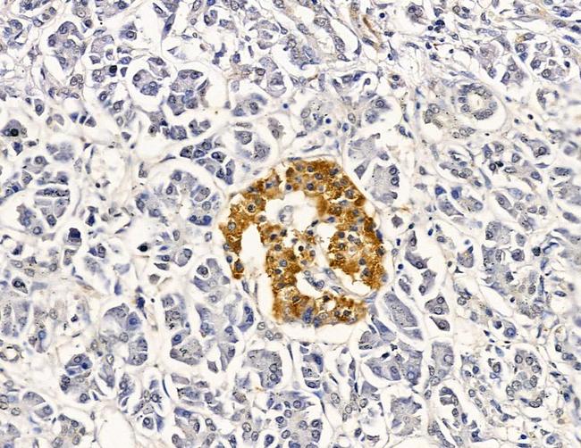 GTSE1 Antibody in Immunohistochemistry (Paraffin) (IHC (P))