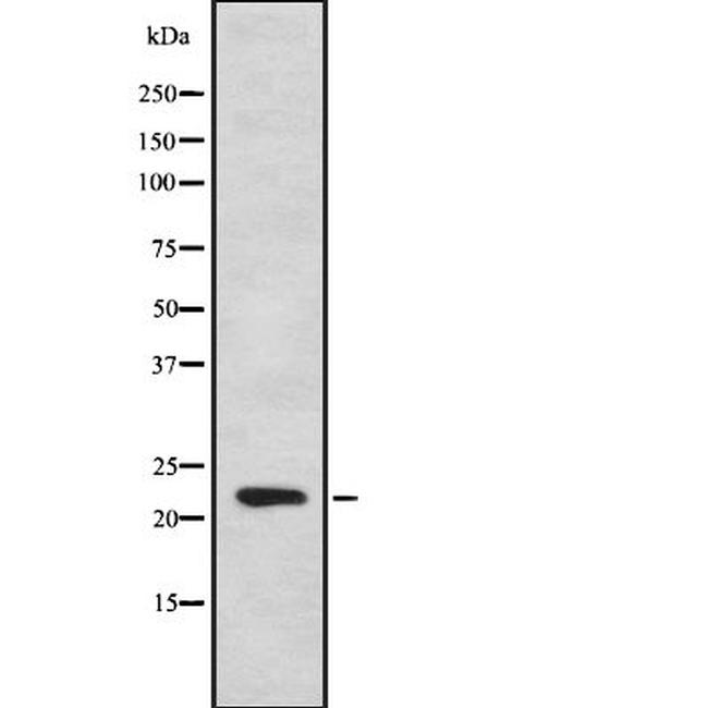 IFNA7 Antibody in Western Blot (WB)