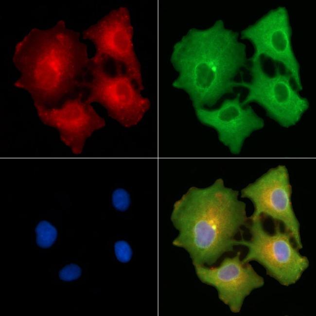 KRT3/6A/75/76 Antibody in Immunocytochemistry (ICC/IF)