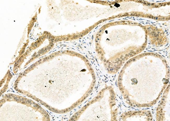 MOZ Antibody in Immunohistochemistry (Paraffin) (IHC (P))