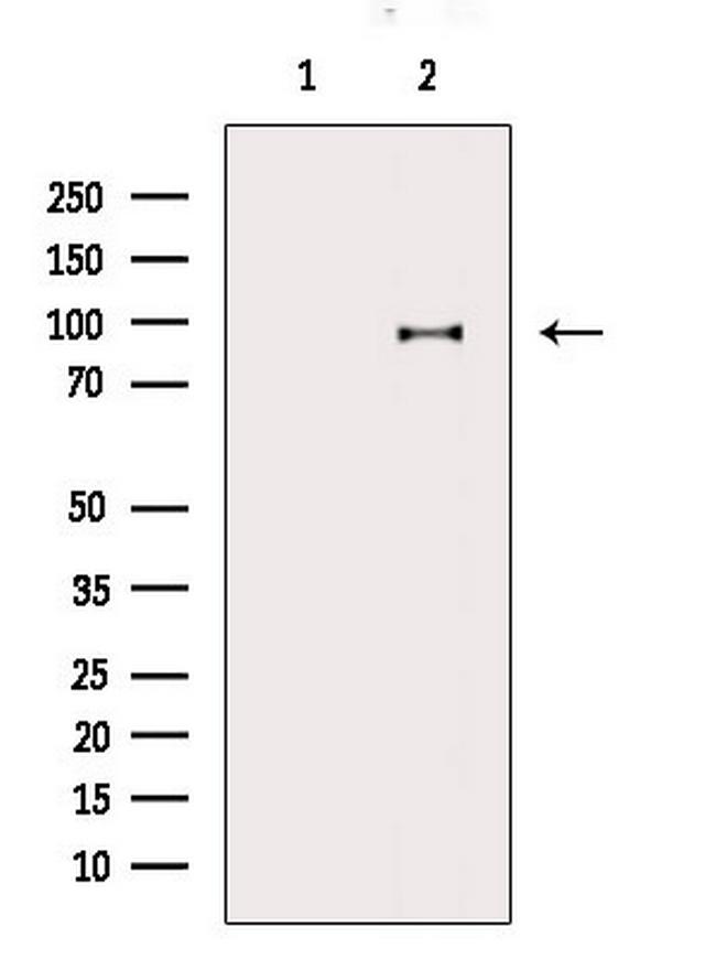 Alix Antibody in Western Blot (WB)