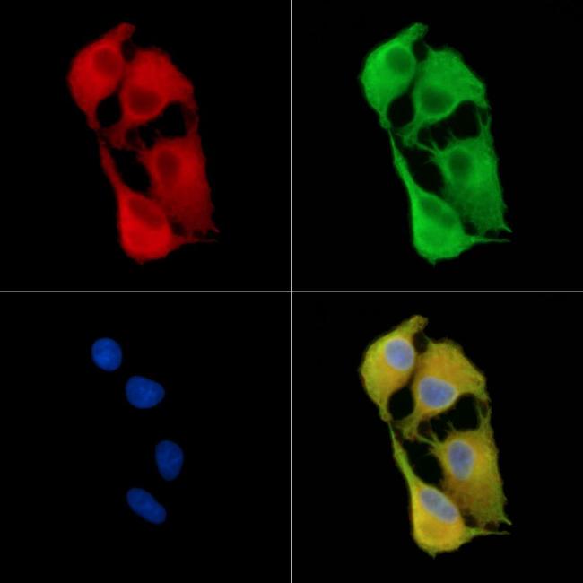 TUBE1 Antibody in Immunocytochemistry (ICC/IF)