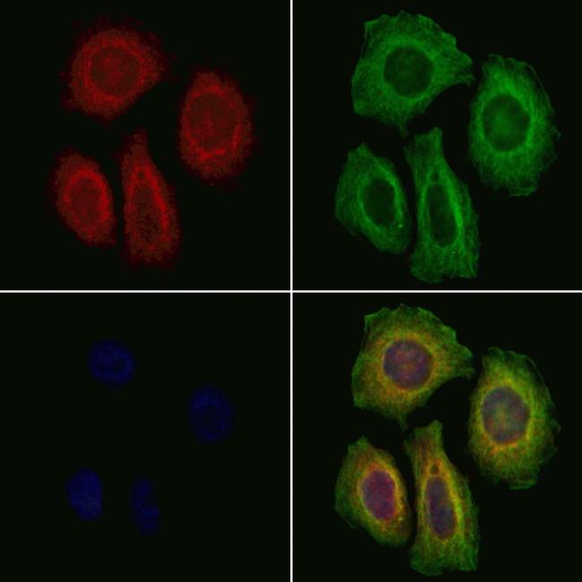 Laminin gamma-2 Antibody in Immunocytochemistry (ICC/IF)