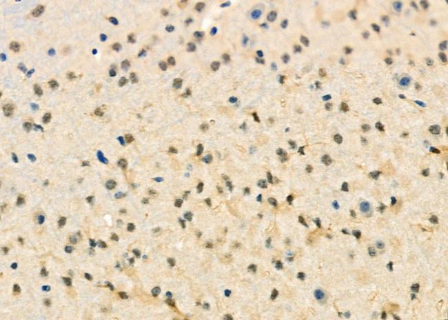 CENPC Antibody in Immunohistochemistry (Paraffin) (IHC (P))