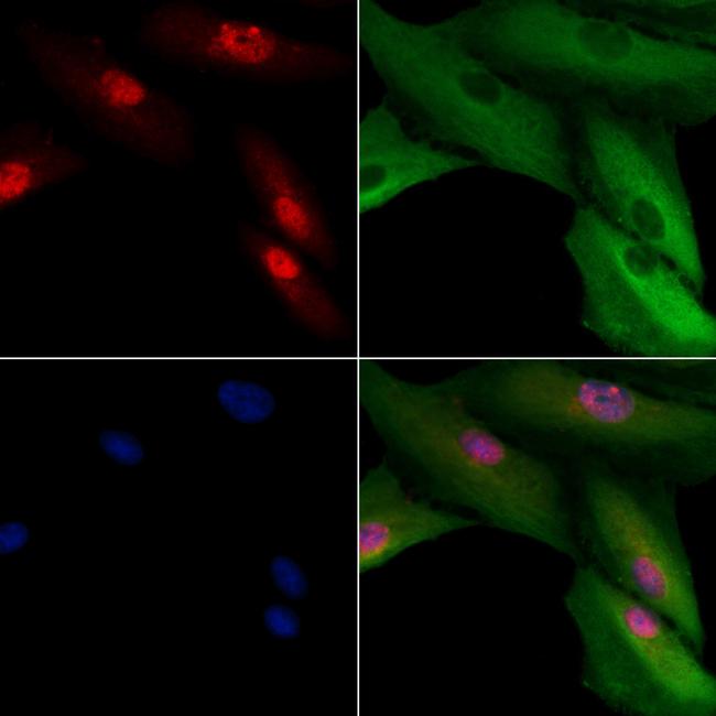 CENPH Antibody in Immunocytochemistry (ICC/IF)