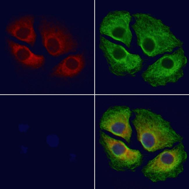 HSD3B1 Antibody in Immunocytochemistry (ICC/IF)