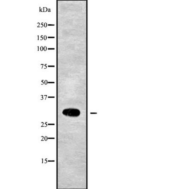 MRPL28 Antibody in Western Blot (WB)