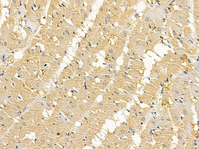 RPL7A Antibody in Immunohistochemistry (Paraffin) (IHC (P))