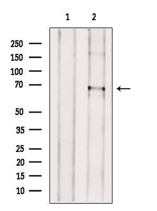 ACOT11 Antibody in Western Blot (WB)