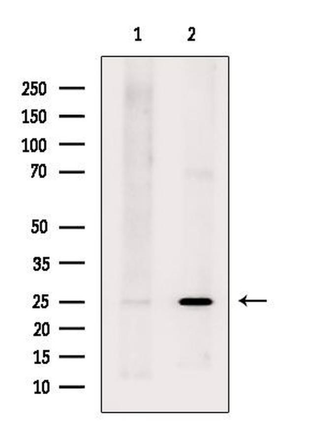 LYPLA2 Antibody in Western Blot (WB)