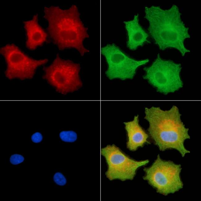 Alsin Antibody in Immunocytochemistry (ICC/IF)