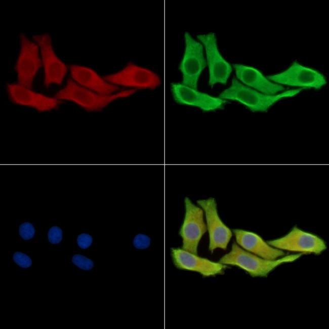 AMPD3 Antibody in Immunocytochemistry (ICC/IF)