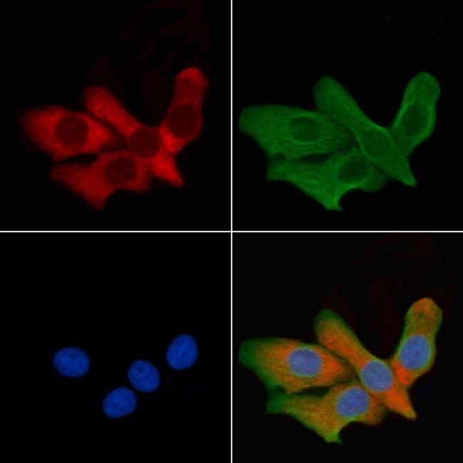 Aquaporin 6 Antibody in Immunocytochemistry (ICC/IF)